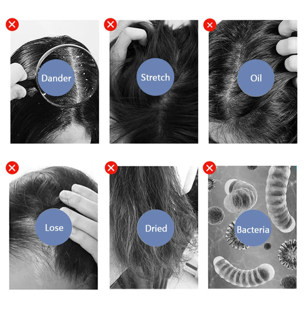 Professional Hair Scalp Analyzer Machine