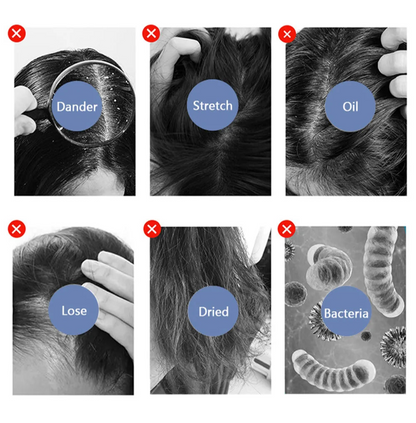 Professional Hair Scalp Analyzer Machine